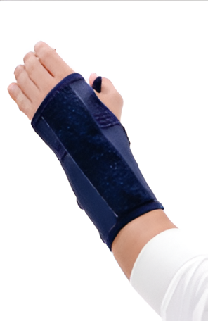 Static Cock-Up Wrist Splint
